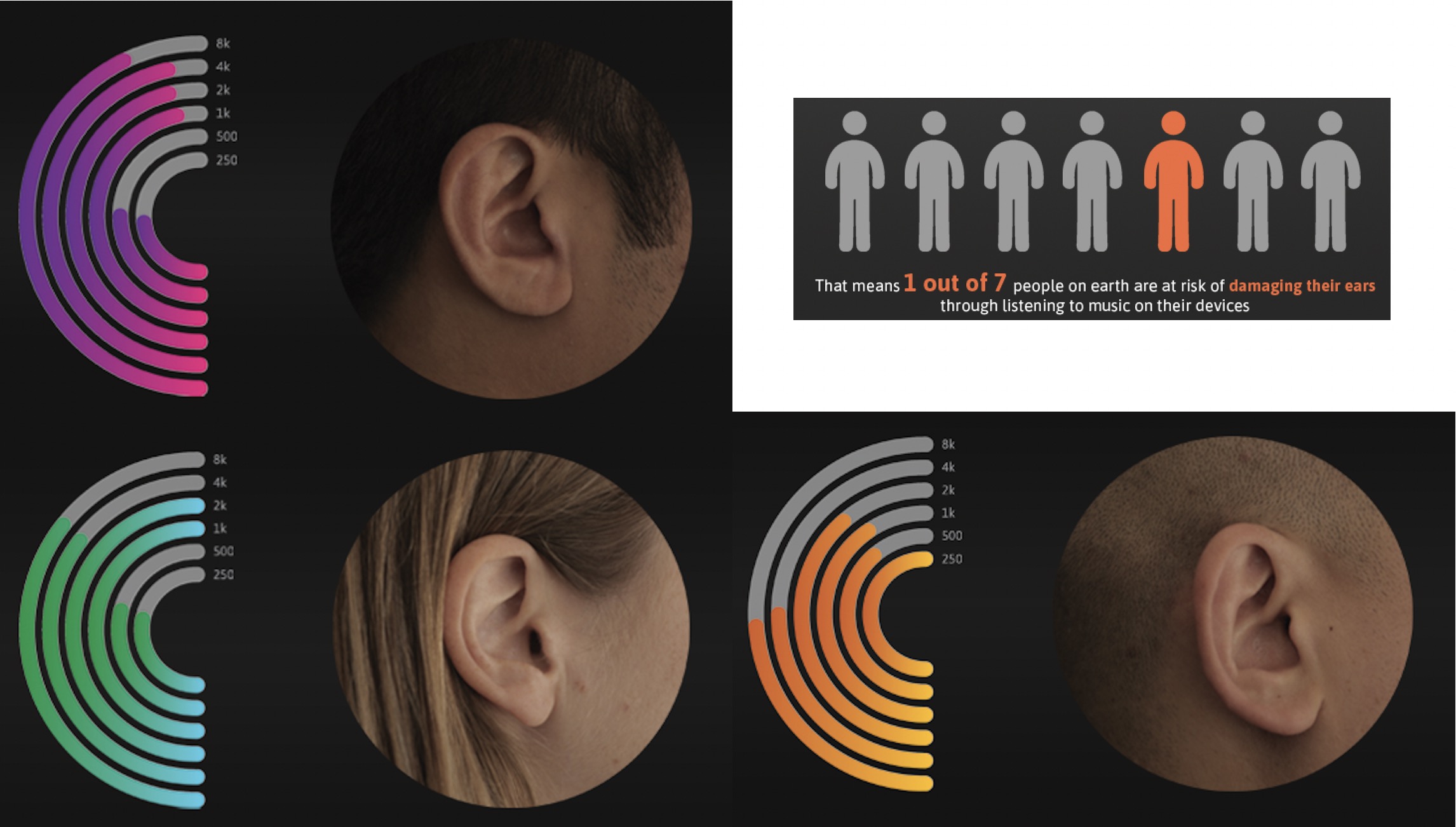 ear-aumeo