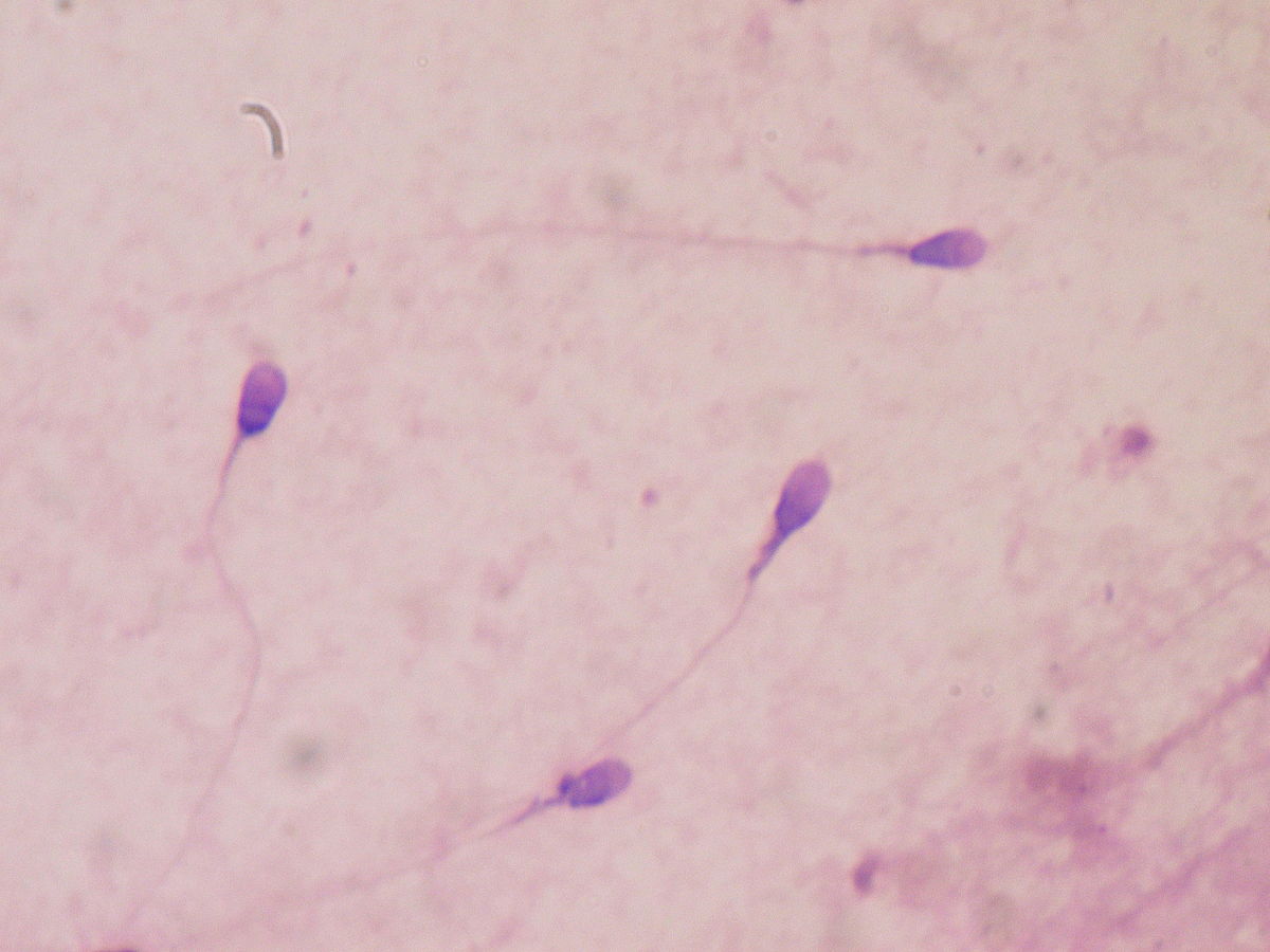 sperm_3