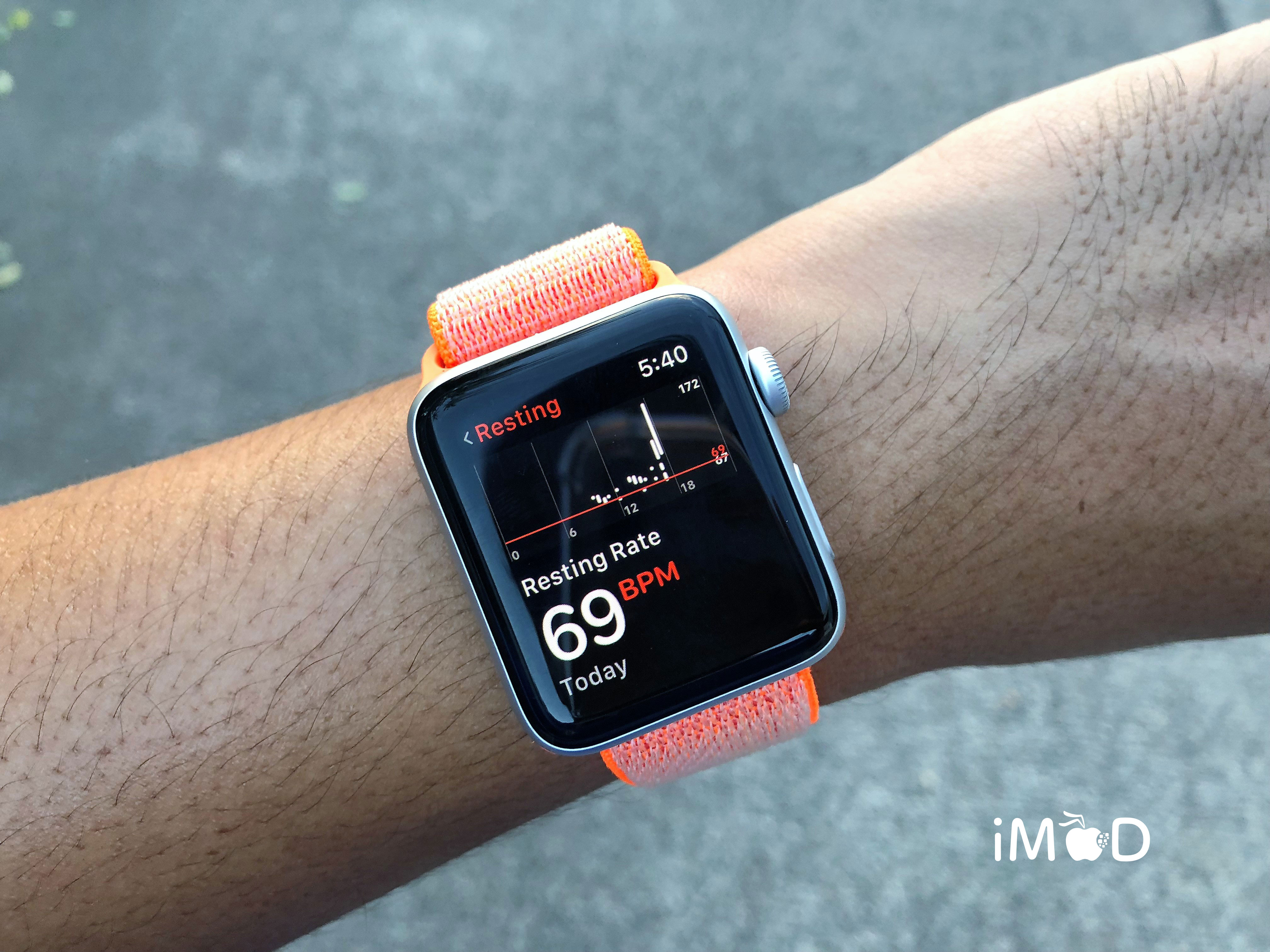 รีวิว Apple Watch Series 3 GPS เหนือขึ้นในทุกขั้น
