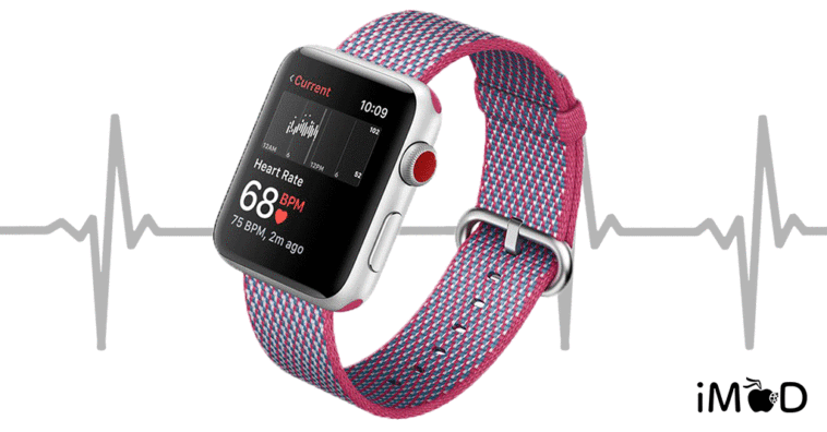 ekg sensor apple watch