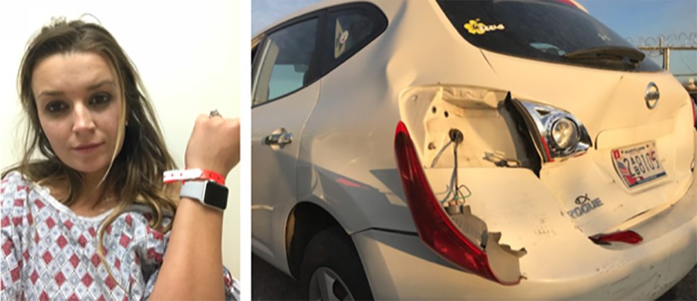 Apple Watch Car Accident Shape