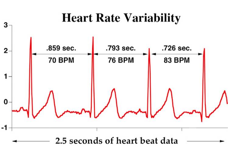 HRV_ต่ำ | techfeedthai