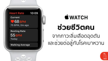 Apple Watch Save Life Blood Clots