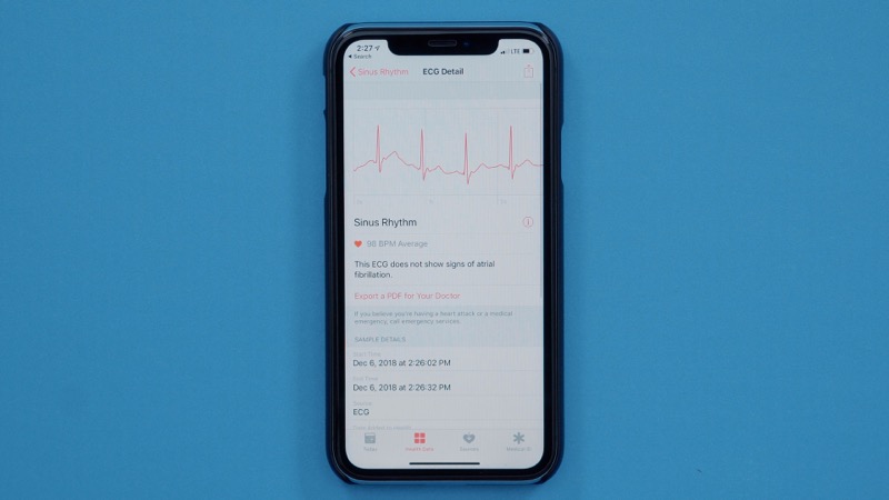 Hands On Ecg Feature On Watchos 5 1 2 America 4