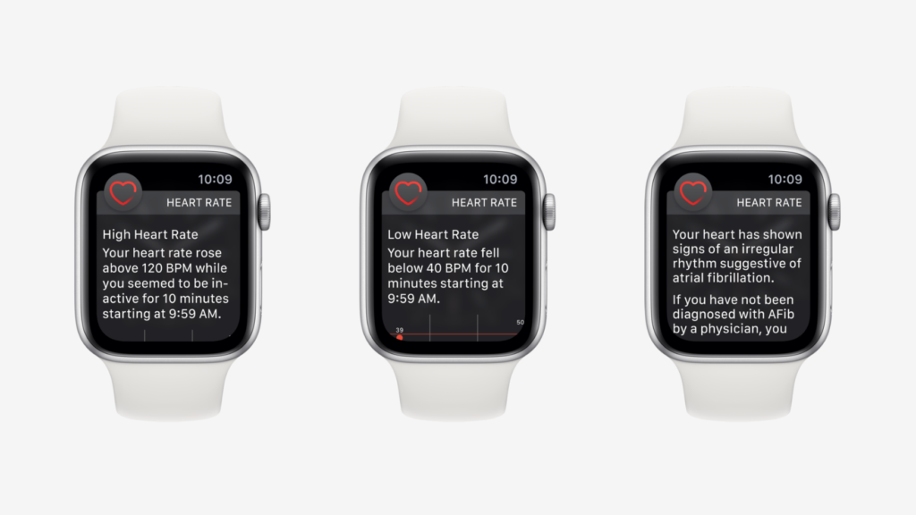 Apple Watch Save Reddit User High Heart Rate Alert 2