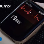 Europe User Detect Afib Ecg Apple Watch Series 4