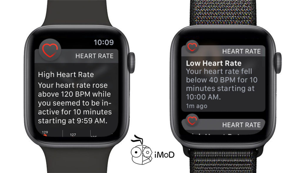 Apple Watch Health Feature 2