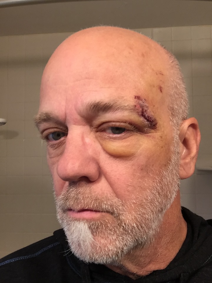 Fall Detection Apple Watch Save Mountain Biker Life 3