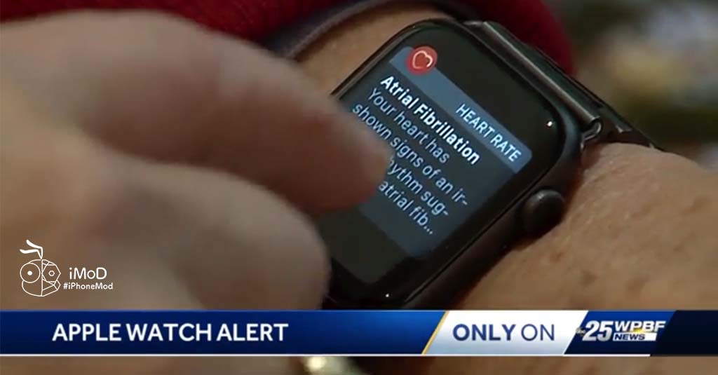 พบข้อมูลคุณสมบัติตรวจจับระดับออกซิเจนในเลือดโดย Apple Watch และปรับปรุง