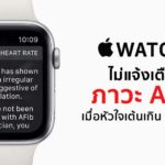 Apple Watch Not Defect Afib If Heart Rate Over 120 Bpm