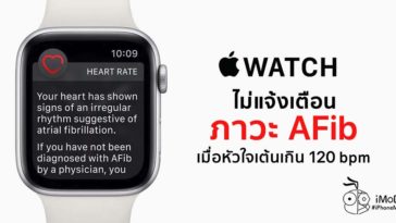 Apple Watch Not Defect Afib If Heart Rate Over 120 Bpm
