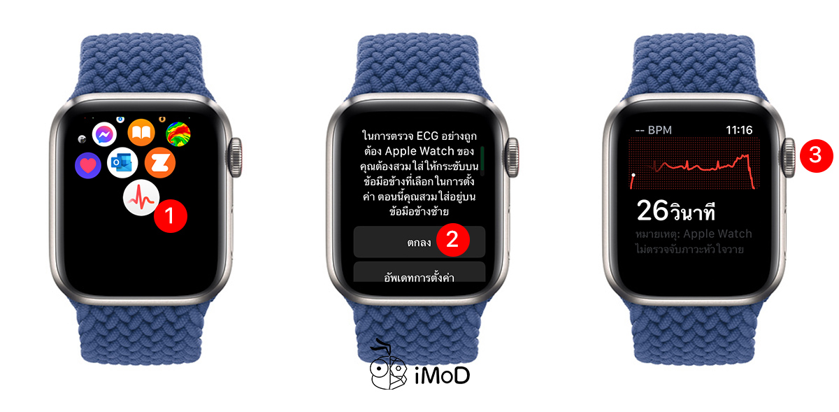 iphone ekg watch