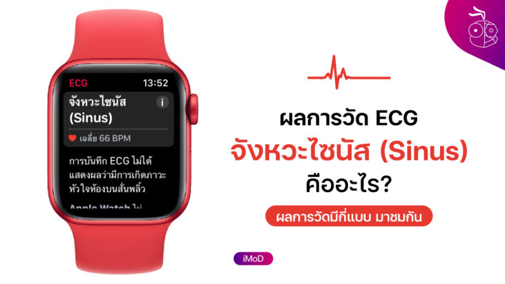 ecg-apple-watch