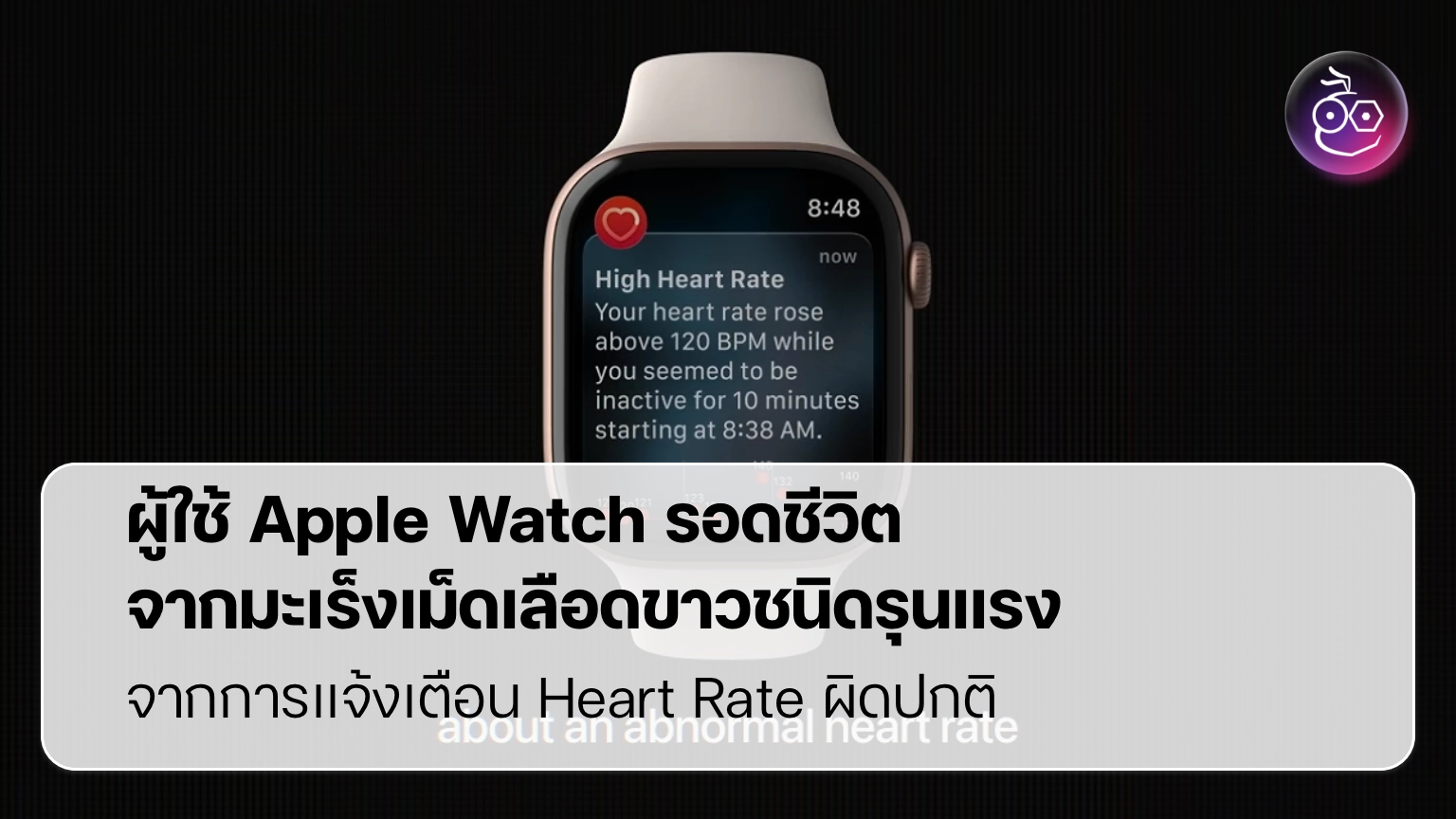 ผู้ใช้ Apple Watch รอดชีวิตจากมะเร็งเม็ดเลือดขาวชนิดรุนแรงจากการแจ้งเตือน Heart Rate ผิดปกติ